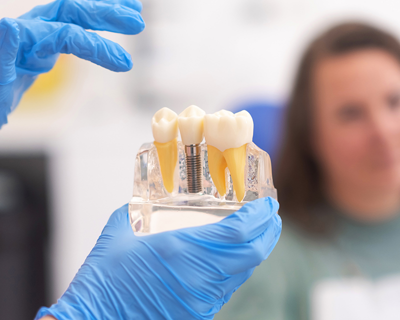 What is a Dental Implant?