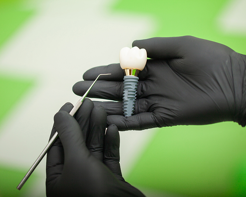 What is a Dental Implant?